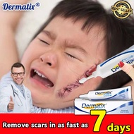 Dermatix Ultra Advanced Scar Formula Acne Scar Removal Cream, Skin Repair Scars Burns Cuts Pregnancy