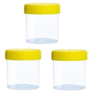 Urine specimen bottle