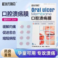 Oral Ulcer Mask Oral Patch Children Pregnant Women Dedicated Mouth Mask Oral Ulcer Relieve Burns Pro
