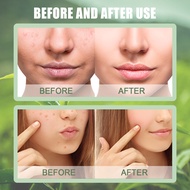 EELHOE green tea solid mask deep cleansing hydrating mask stick pore shrink coating mud mask stick