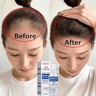 Hair Growth Tonic Hair Serum for Grow Hair Anti Hair Loss Herbal Care Essence 60ML for Men and Women