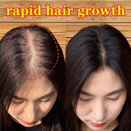 【Hot selling in Japan】Hair Regrowth Tonic Hair Regrowth Shampoo 200ml Hair Regrowth Anti Hair Loss Treatment Rapid Hair Growth Rapid Hair Regrowth Anti-Dandruff Shampoo Hair Regrowth Tonic For Men &amp; Women