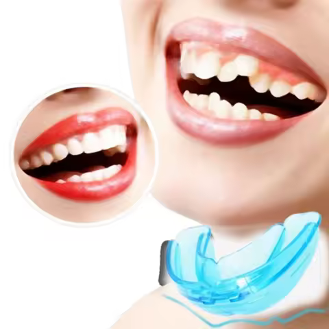 Shock Doctor Mouth Guard for Braces, Upper Teeth Protection, Instant Fit, Adult & Youth Sizes,Blue