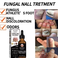 Eelhoe Nail Repair Gloss Nail Nutrition Solution Thickening Remove Gray Nail Dead Skin Solution Repa