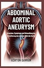 Abdominal Aortic Aneurysm: Ursachen, Symptome und Behandlung der Erweiterung des unteren Teils der A