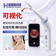 [mc] Visualized Tonsil Calculus Remover Oral Cleaning Care Tool Oral Cleaning Care Tool Calculus Rem