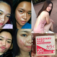 100% LEGIT NA SABON PAMPAPUTI PAMPAKINIS Kagayaku Haku Bleaching Whipped Soap 20x INSTANT WHITENING With SCAR REMOVER (70gms) (Glutathione, Collagen, and Alpha Arbutin)10000x whitening effect premium Korean Kagayaku haku soap