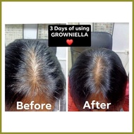 ① ├ ➔ Growniella Hair Growth Spray 100ml Growniella Hair Grower & Treatment