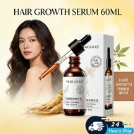 Hair Growth Serum 60ML Anti-hair Loss Essence Treatment For Hair Loss Hair Tonic Promote Hair Growth