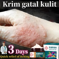 Ubat gatal kulit Ubat gatal kemaluan Econazine cream antifungal Ubat kurap Krim gatal celah kangkang