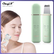❤ Ckeyin Ultrasonic Skin Scrubber EMS Ion Import Facial Lifting Vibration Massager Deep Face Pore Cl