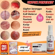 ubat gatal kulit panau mujarab obat gatal krim gatal kulit sabun gatal kurap eczema ubat gatal celah