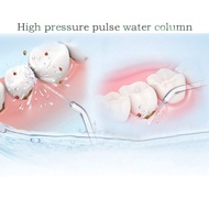 GB Dental Water Flosser Replacement Tips Nozzles Oral Irrigators Jet Tips Pressure Water Flosser Ref