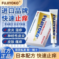 Quick Itching Cream Skin Itching External Use Anti-Itching Hands Foot Dry Itching Fungus Itching Ext