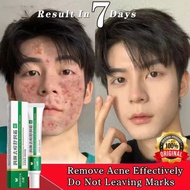 Acne Removal Cream penghilang flek hitam - Salep cina ampuh Penghilang Flek Hitam Membandel Di Wajah