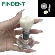 Dental Implant Teeth Model Clear Implant Denture Model Crystal Crown Typodont Structure For Teaching