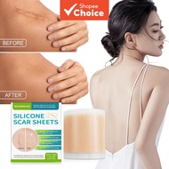 Silicone Scar Care Tape Roll 4x150cm - Reusable Sheets For Post-Surgery C-Section Burn & Keloid