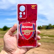 🔥เคส Xiaomi 12 / Mi 12T / Mi12 Pro 🔥ขอบนุ่ม หลังอะคริลิคแข็ง กันกล้อง กันกระแทก พร้อมส่งจากไทย🇹🇭