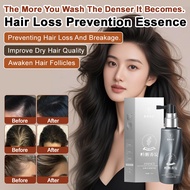 【Reduces Breakage & Hair Fall】JM Hair Growth Serum/Anti-Hair Loss Treatment/Hair Strengthening Essen