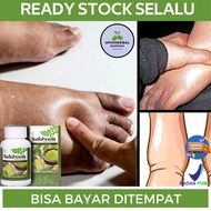 Obat Kaki Bengkak Karena Gula / Diabetes Obat Pengempis Kaki Bengkak Obat Kaki Bengkak Penumpukan Ca