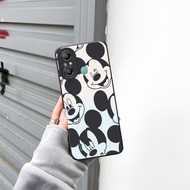 (PC02) Case Procamera Itel Vision A49 Itel Vision 1 Pro Itel A60 Itel A60s Itel A26 Itel A27 Itel P4