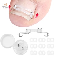 { MY Fashion }   1/2 Set Ingrown Toenail Corrector Tools Pedicure Recover Embed Toenail Treatment Pr