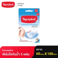 Tigerplast ไทเกอร์พล๊าส พลาสเตอร์ปิดแผล ฟิล์มใสกันน้ำ N2