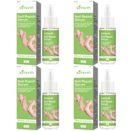 Ximonth nail care essence nail repair essence nail care serum nail care soft nail polish Polish thic