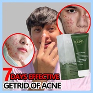 Acne foaming cream cleanser anti acne cleanser pimple removal 100g effectively remove acne scars 祛痘膏