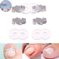 Alittlesearch 1/2 Set Ingrown Toenail Corrector Tools Pedicure Recover Embed Toenail Treatment Profe