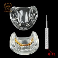 1PC Dental implant model edentulous jaw gold cap half-mouth comprehensive pathological implant resto