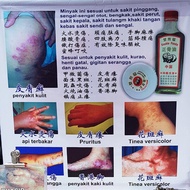 Ubat Ekzema Eczema Gatal Pati Gelenggang Gatal Panau Kudis