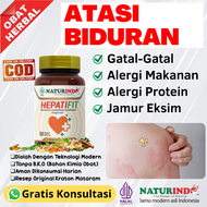 Obat Biduran Paling Ampuh Obat Gatal Alergi Dingin Obat Biduran Dewasa Obat Biduran Untuk Anak Obat 