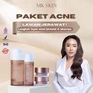 (READY TO SHIP) MK SKIN SKINCARE ACNE PACKAGE