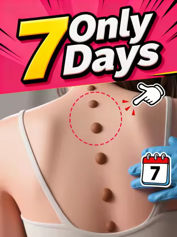 Bestselling body tools Little blue bottle remove wartsTechnology changes life and wart freeze , wart