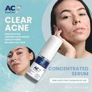 AC7D Serum Concentrated 10ml (Low Stock) - Acne Clear 7 Days | Acne Treatment for Acne-Prone Skin | 