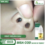 Obat Tetes Hidung Berbau Busuk - Penghilang Benjolan Sinusitis Ingus Pilek Menahun - Propolis Sm