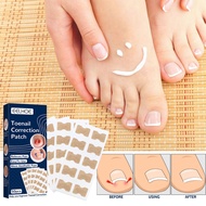 Toenail Correction Patch Nail Correction Patch Ingrown Toenail Correction Repair Patch Repair Toenai