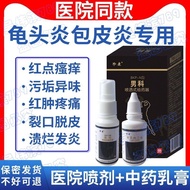 Men's Lotion Glans inflammation medicine, foreskin inflammation, sexually transmitted disease medici