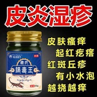 Eczema Troubled Fungus King Eczema Cream Eczema Special Cream Skin Itching Dermatitis Eczema Anti-It