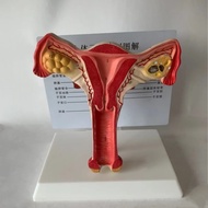 Human health, uterine anatomy, artery, vessel, ovary, cervix,  Teaching demonstration, maternal and 