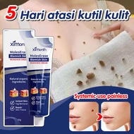 obat kutil paling ampuh oles / Penghilang Kutil / Menghilang Kutil Area Intim Daging Wajah Kutil Dat