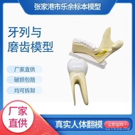 Tooth Anatomy Bionic Tooth and Medical Model Teaching Human Body Model zm1050 Column Model Tooth Gri