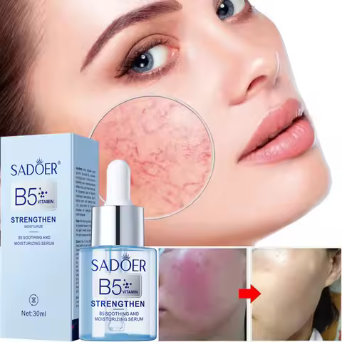 Facial Redness Repair Serum Improve Sensitive Muscles Acne Rosacea Dry&Itchy Skin Moisturizer Lotion