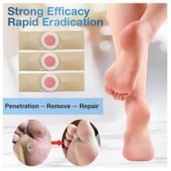 CORN PLASTER REMOVER 6Pcs Corn remover penghilang ketuat Rawat ketuat hilangkan ketuat hilangkan hin
