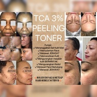 TCA PEELING TONER 3% Glycolic Acid Toner AHA BHA Toner for Face