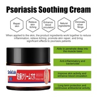 COD Psoriasis Eczema treatment cream anti fungal cream 30g krim gatal kulit ekzema ubat gatal gatal