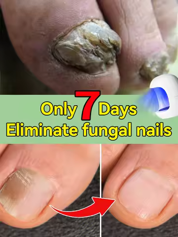 Technology changes lives,Rejuvenator - Fungus Prevention Technology - Adjustable Control & Safety Se