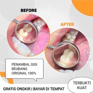 Hepishop PALING KUAT TIDAK KUNING Gigi Palsu Penutup Ompong Depan Dewasa Anak Penutup Gigi Ats Palsu