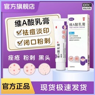 Zidouwei A Acid Cream 20g Latex Acne Removal Ointment For Medical Wart Removal Mupirocin Ointment Ad